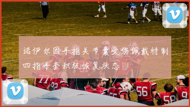 诺伊尔因手指关节囊受伤佩戴特制四指手套积极恢复状态
